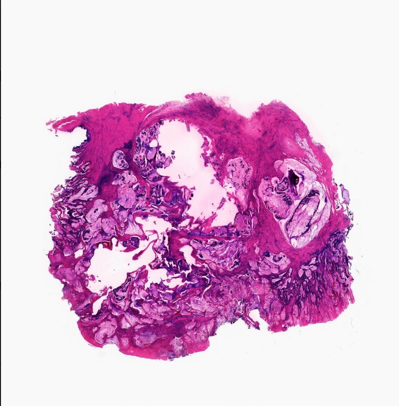 A stained tissue sample produced by QuantumCyte technology: an organic mass of magenta, violet and white.