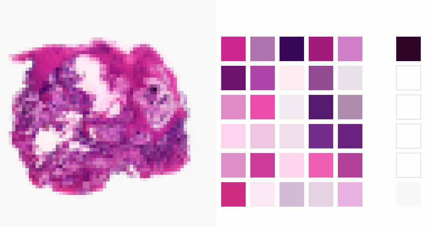 The same tissue image pixelated beside a grid of magenta, violet, lilac and pale pink swatches pulled from it.